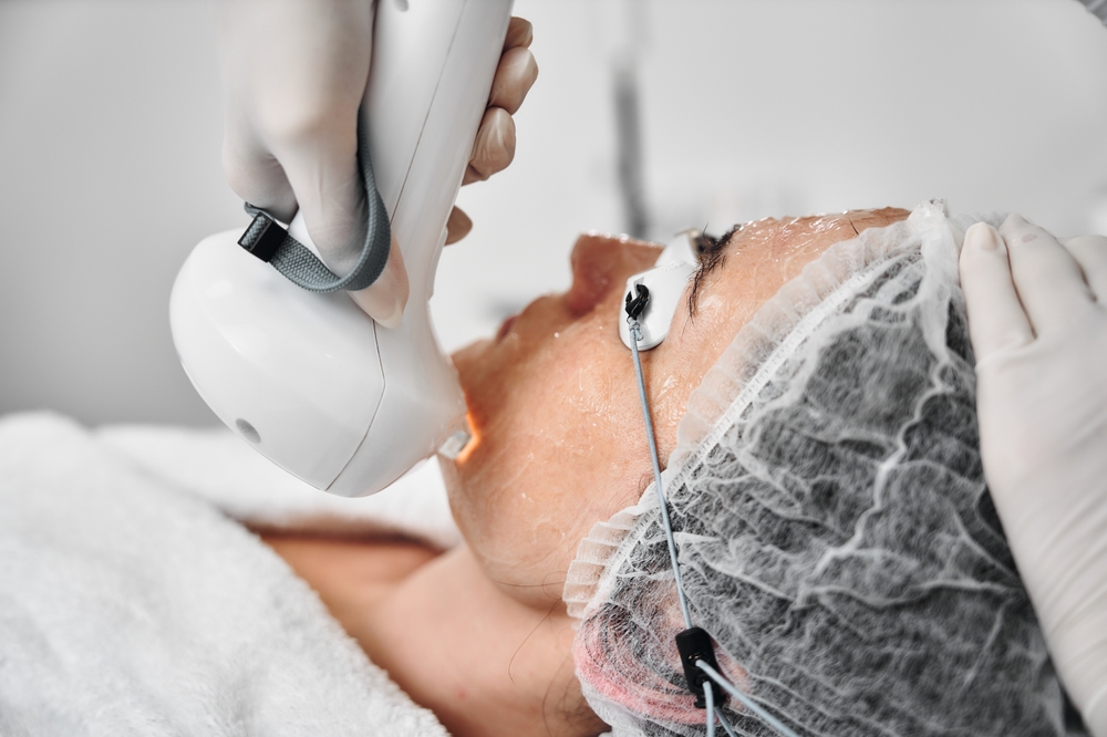 IPL Laser